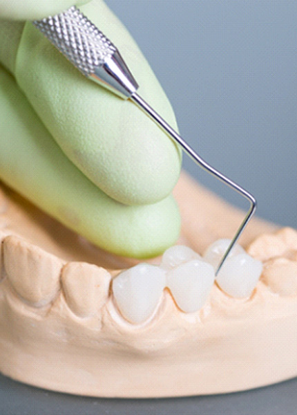 lab tech inspecting a dental bridge in South Portland