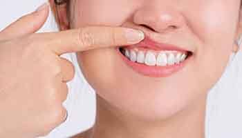 Woman showing her gums