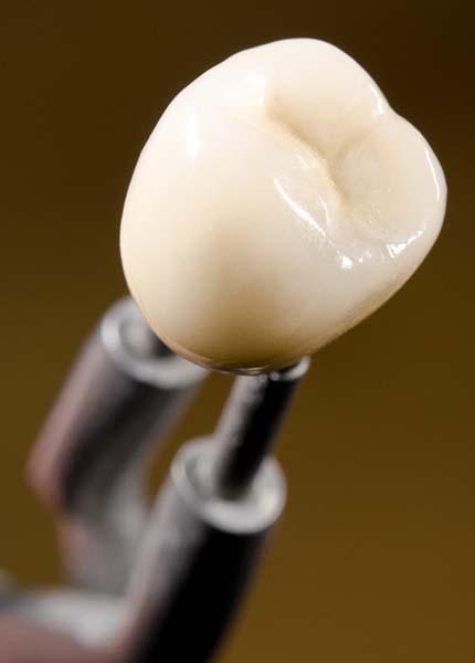 All-ceramic dental crown in labratory
