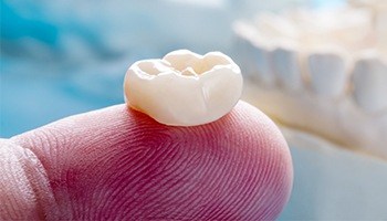 Person holding a lost dental crown on their finger tip