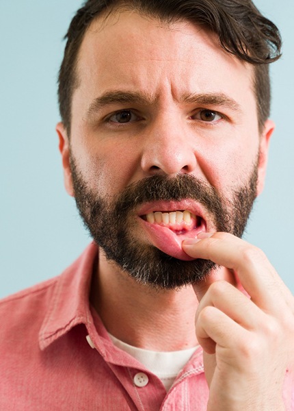 man showing gums 