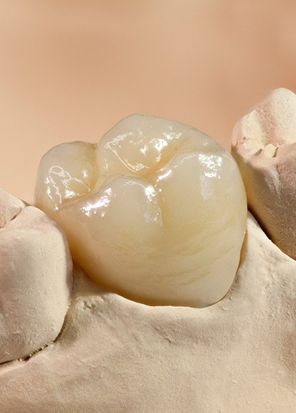 Model smile with dental crown restoration