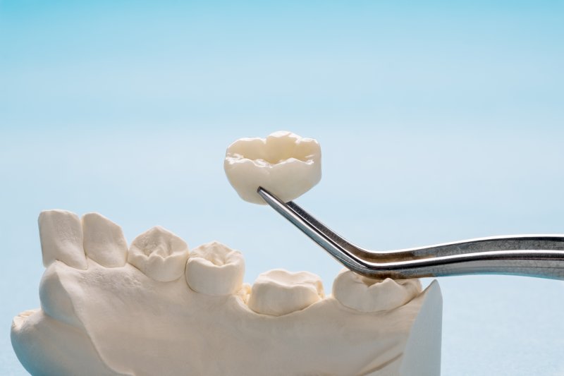 Tweezers holding a single dental crown