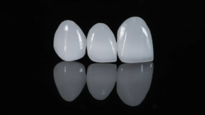 Three veneers standing in a row on a black reflective surface